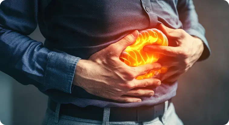 Acidity & Acid Reflux