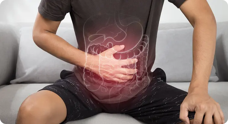 Irritable Bowel Syndrome (IBS)