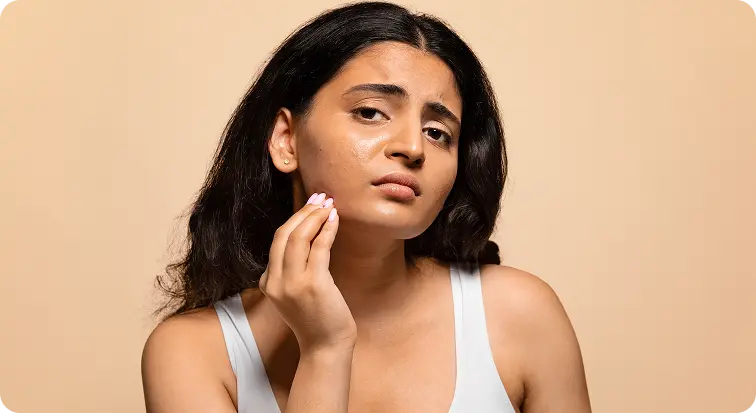 Acne & Skin Concerns